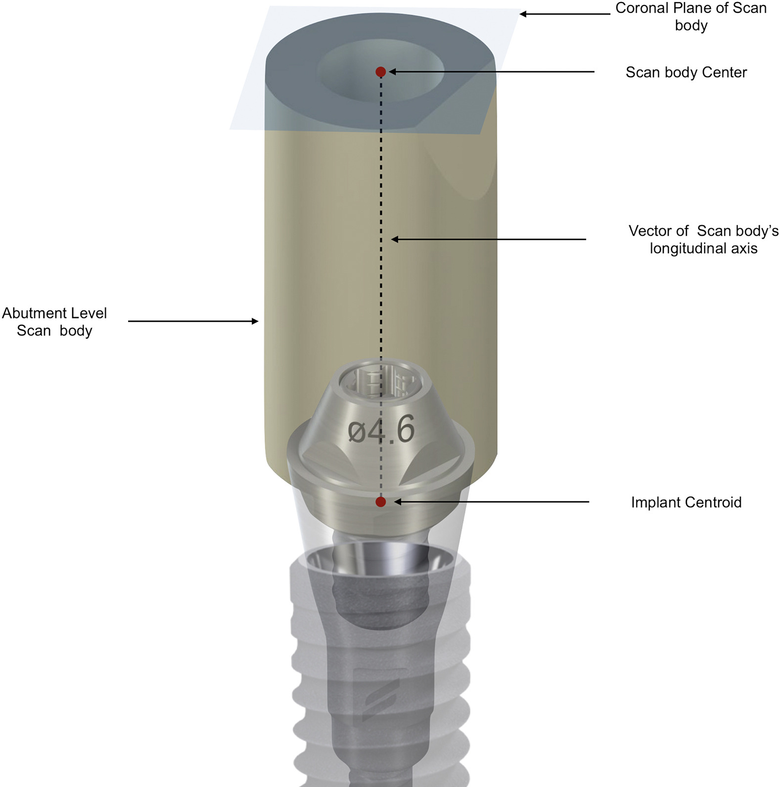 abutment-tason skannausrunko-osat